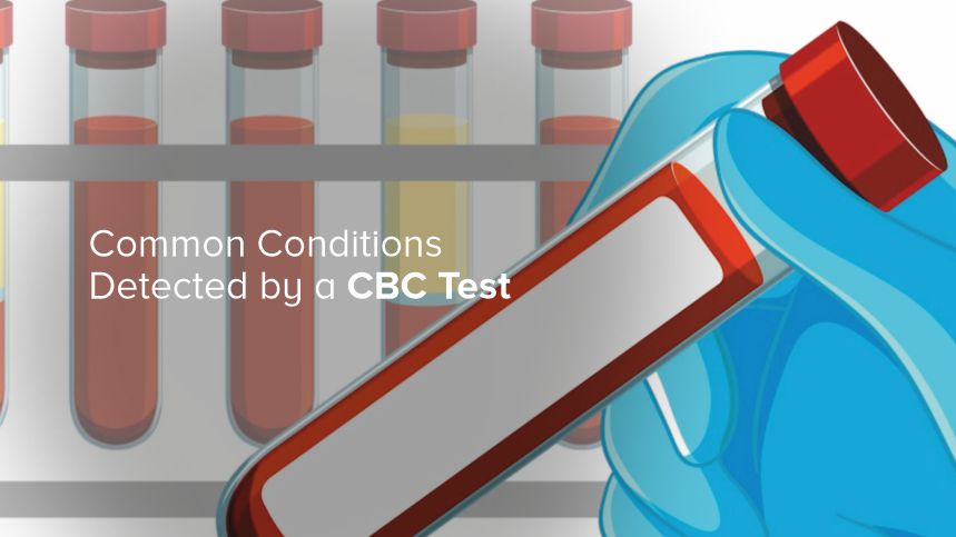 Common Conditions Detected by a CBC Test